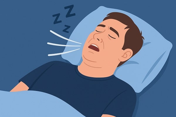 Uyku Apnesi Nedir? Belirtileri ve Tedavi Yöntemleri