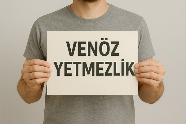 Venöz Yetmezlik Nedir? Belirtileri ve Tedavi Yöntemleri