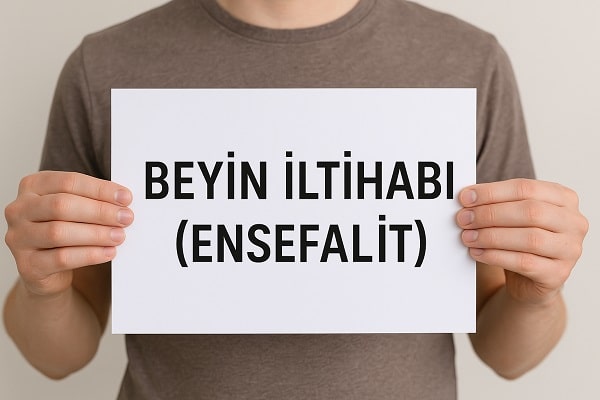 Beyin İltihabı (Ensefalit) Nedir? Belirtileri ve Tedavi Yöntemleri