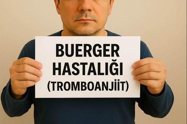 Buerger Hastalığı Nedir? Belirtileri ve Tedavi Yöntemleri